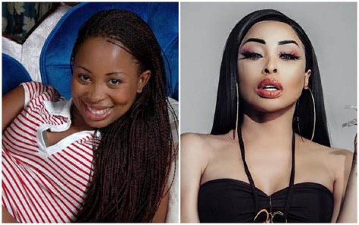 Sabrina's Transformation Journey: A Deep Dive Into Her Before And After Surgery