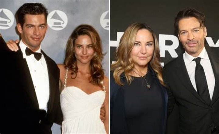 Unveiling The Charm Of Harry Connick Jr.'s Crooked Smile