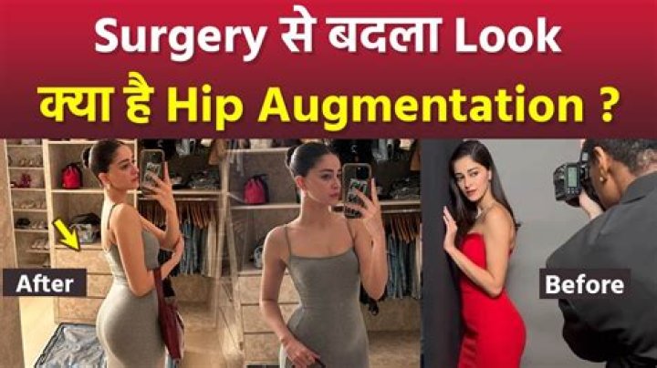 Unveiling The Truth Behind Alanna Panday's Plastic Surgery Journey