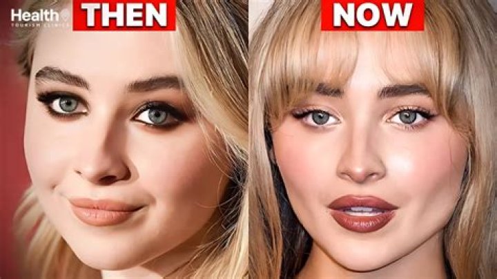 Unveiling The Truth: Has Sabrina Carpenter Gotten Plastic Surgery?